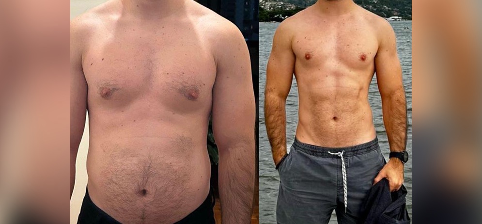 Antes e depois 2