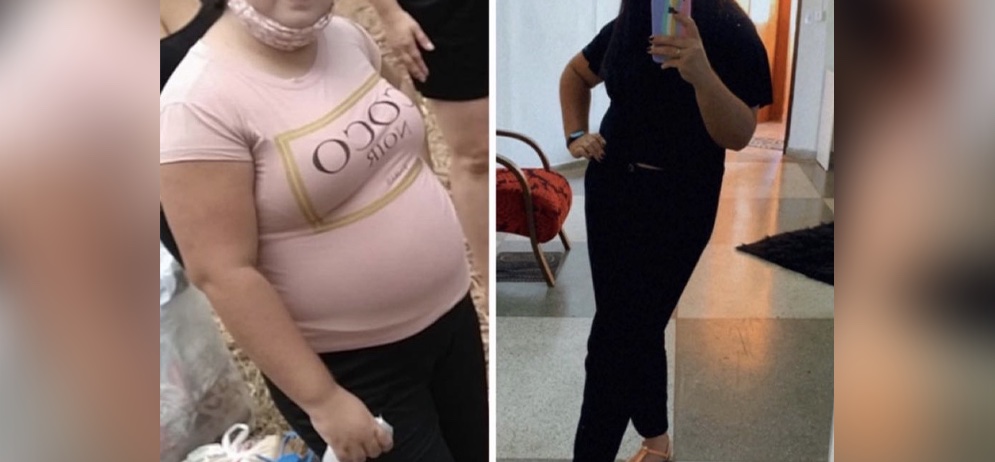 Antes e depois 6