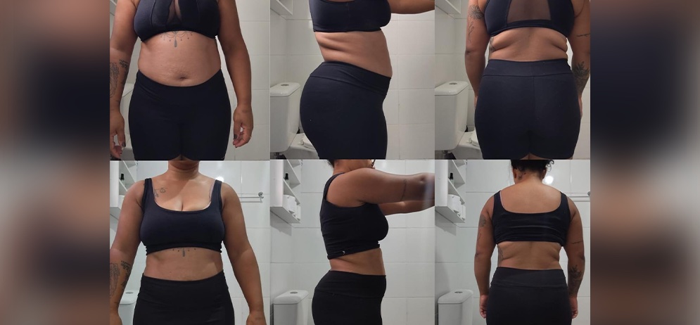 Antes e depois 8